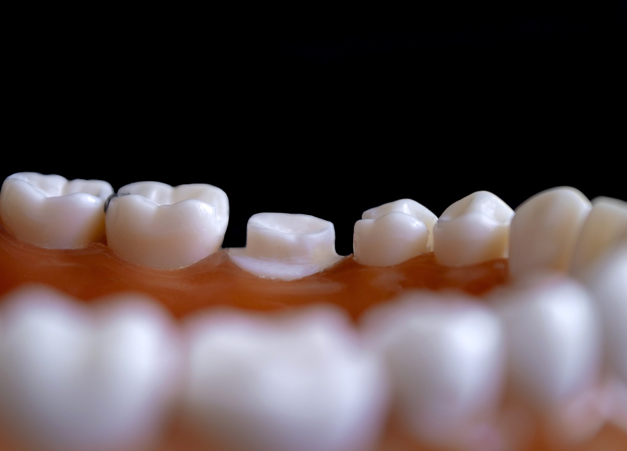 矯正のコスパ重視での口コミに見る良い点と悪い点は？